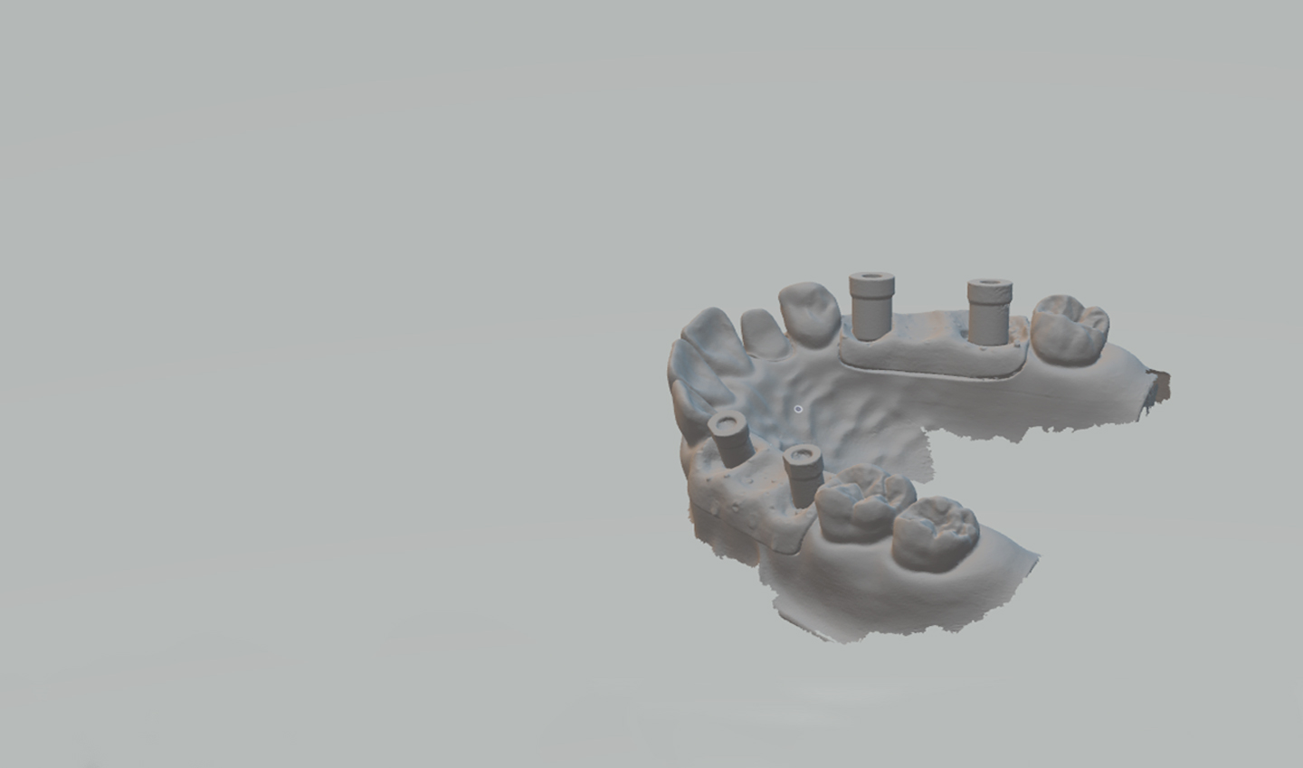 Scan Abutment